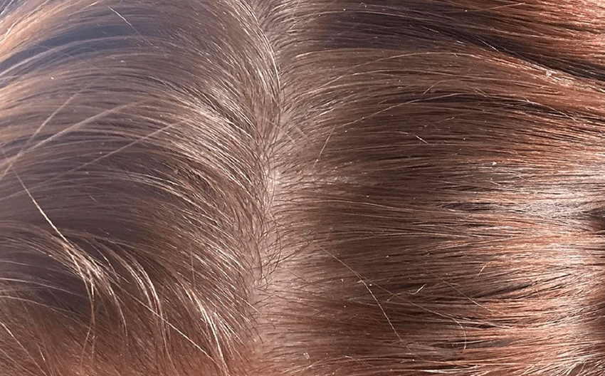 Na gebruik Apotecari