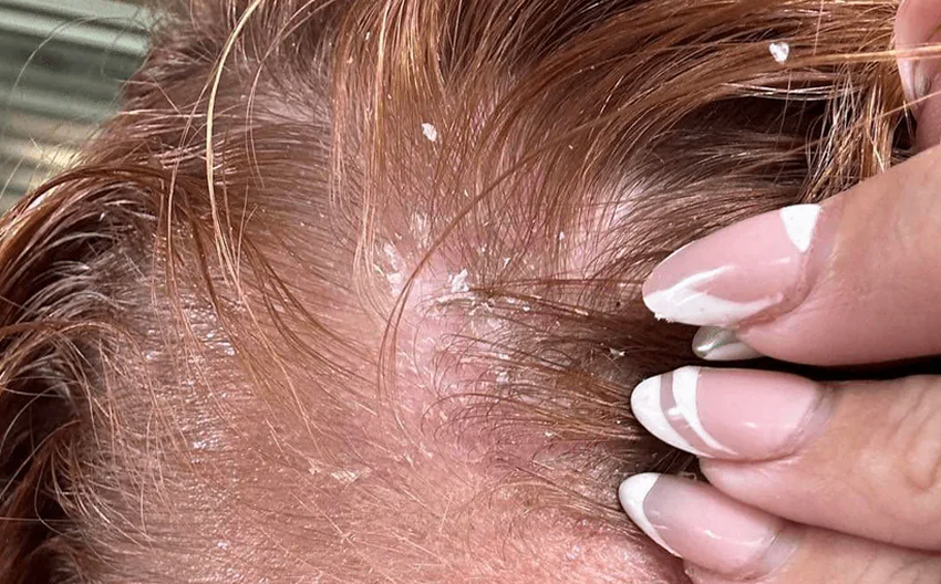 Voor gebruik Apotecari